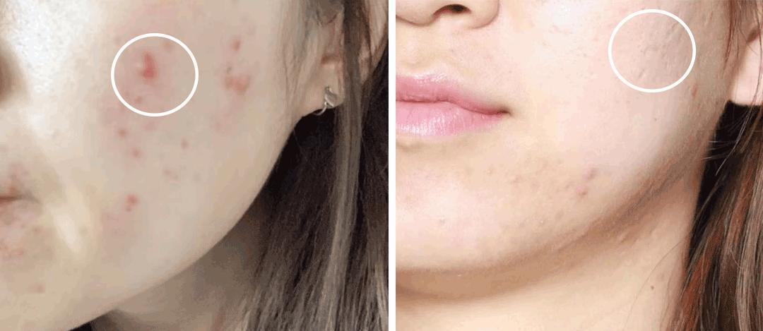 无效遮瑕测评,无效遮脸