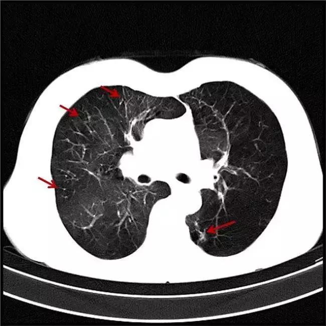 拍了片子拿到结果看不明白？彩虹医生教您看懂影像报告