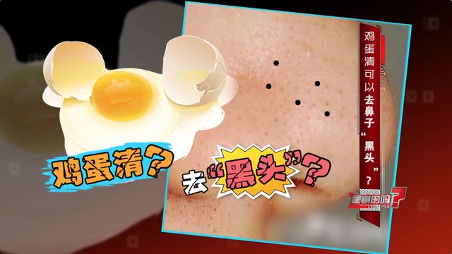 牙膏和小苏打一起用可以去黑头吗,为什么去黑头要纯白牙膏