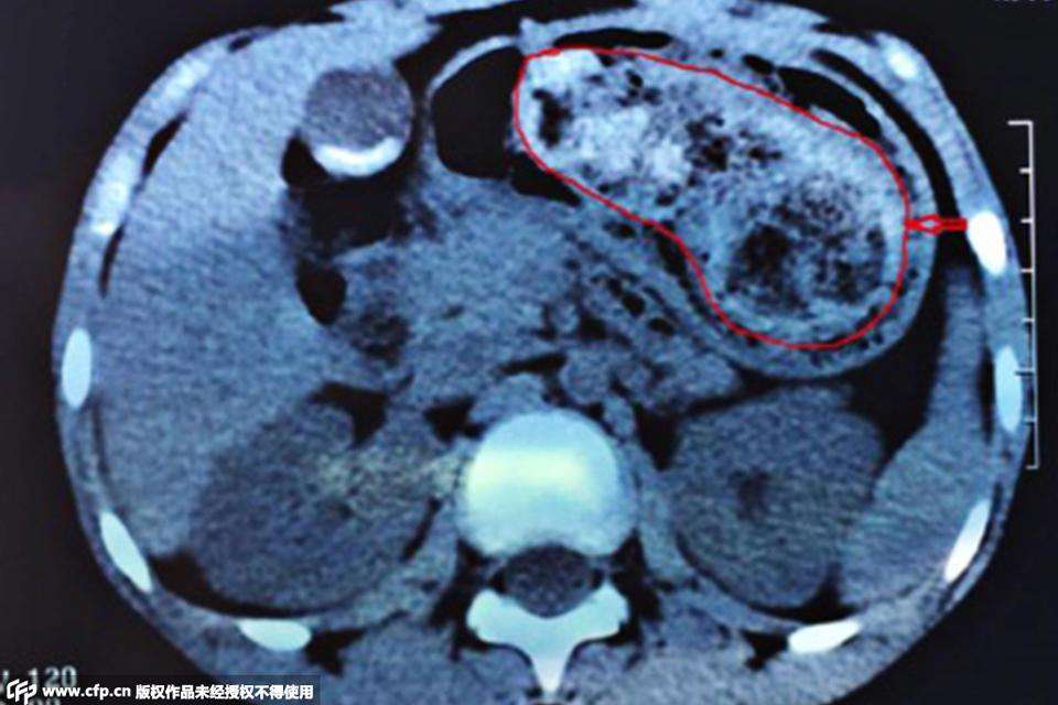 山楂枣去积食,山楂红枣苹果水健脾胃吗