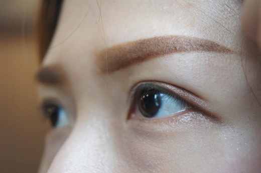 激光洗红眉的操作方法视频,红眉能激光吗