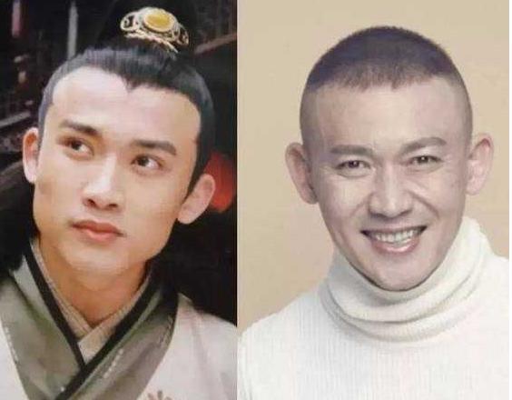 那些一刀切削骨的明星还好吗？后遗症一大堆，小方脸成最大赢家