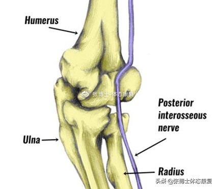运动肘关节常见创伤及治疗方法,怎么预防肘关节康复二次损伤