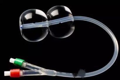 宫颈不成熟放水囊催生成功率高吗,怀孕41周还没发动要不要住院催产