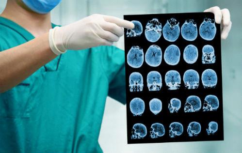 空腹做体检真的一点水都不能喝吗,体检空腹能喝一口水吗