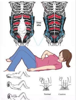 产后腰酸背疼怎么缓解修复,产后腰酸背痛多久可以恢复