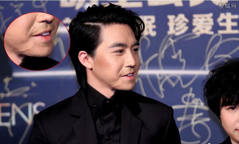 俞灏明烧伤事件真相大揭秘,俞灏明烧伤事件图片曝光