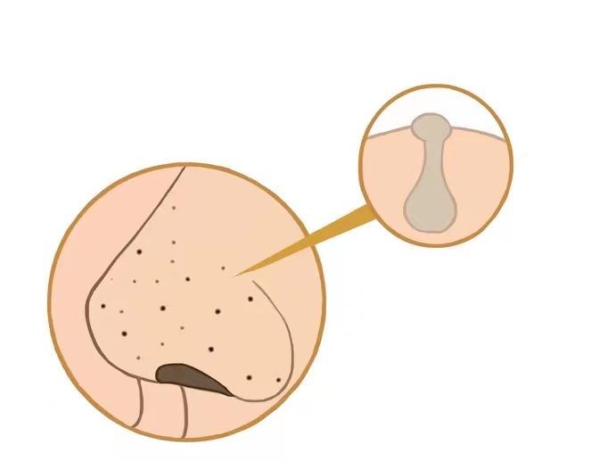 欣兰冻膜能代替科颜氏白泥吗,dmc欣兰冻膜科颜氏白泥