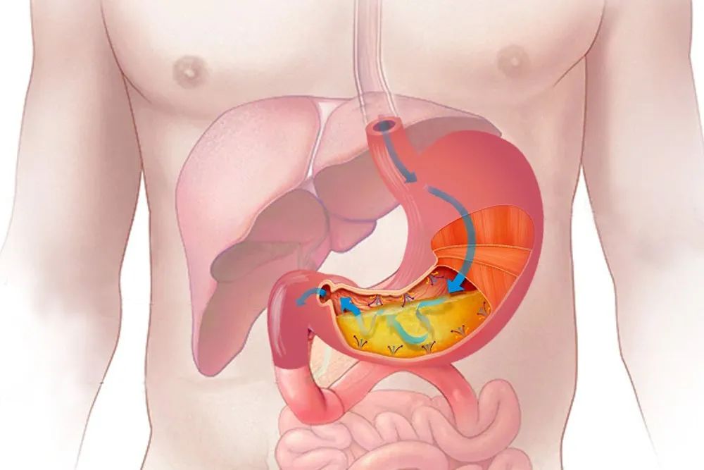 消化不好，百病生，科学提高胃酸13招，解决一半小毛病