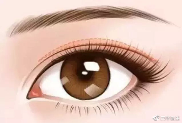 科普篇眼部整形的七大误区,关于眼整形这些事你一定要知道