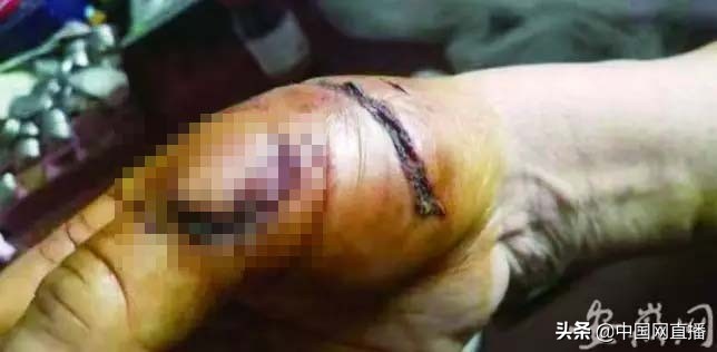 藏獒咬人被人反杀,150斤藏獒伤人被击毙