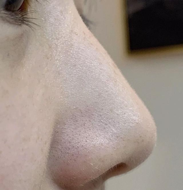 美容院去黑头前敷的东西,美容院去黑头面膜