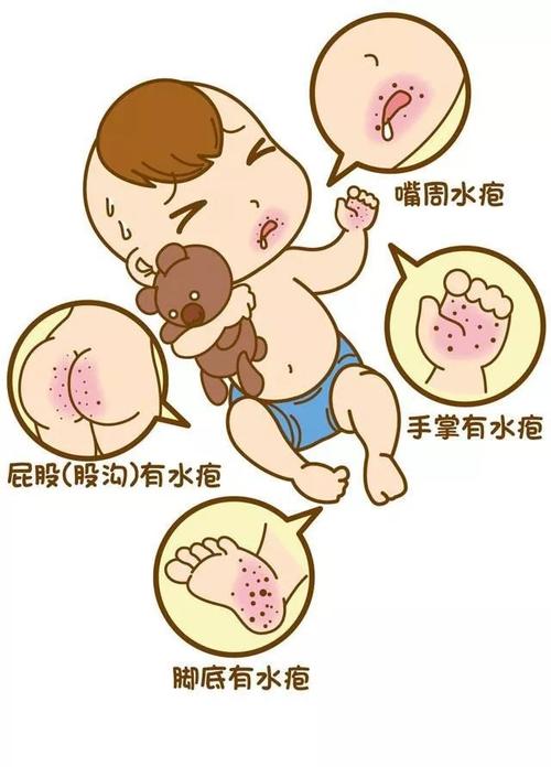 水痘疱疹丘疹一起出现,季节交替带状疱疹进入高发期