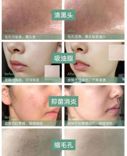 火山泥真是宝,油皮女孩的毛孔疏通剂,让贵妇霜3秒吃透锁水8倍