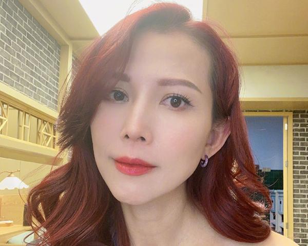 蔡少芬上节目打疫苗,蔡少芬录节目时被狗咬伤