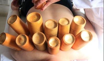 拔火罐要注意些什么？医生说：避免这6个误区和10个注意事项