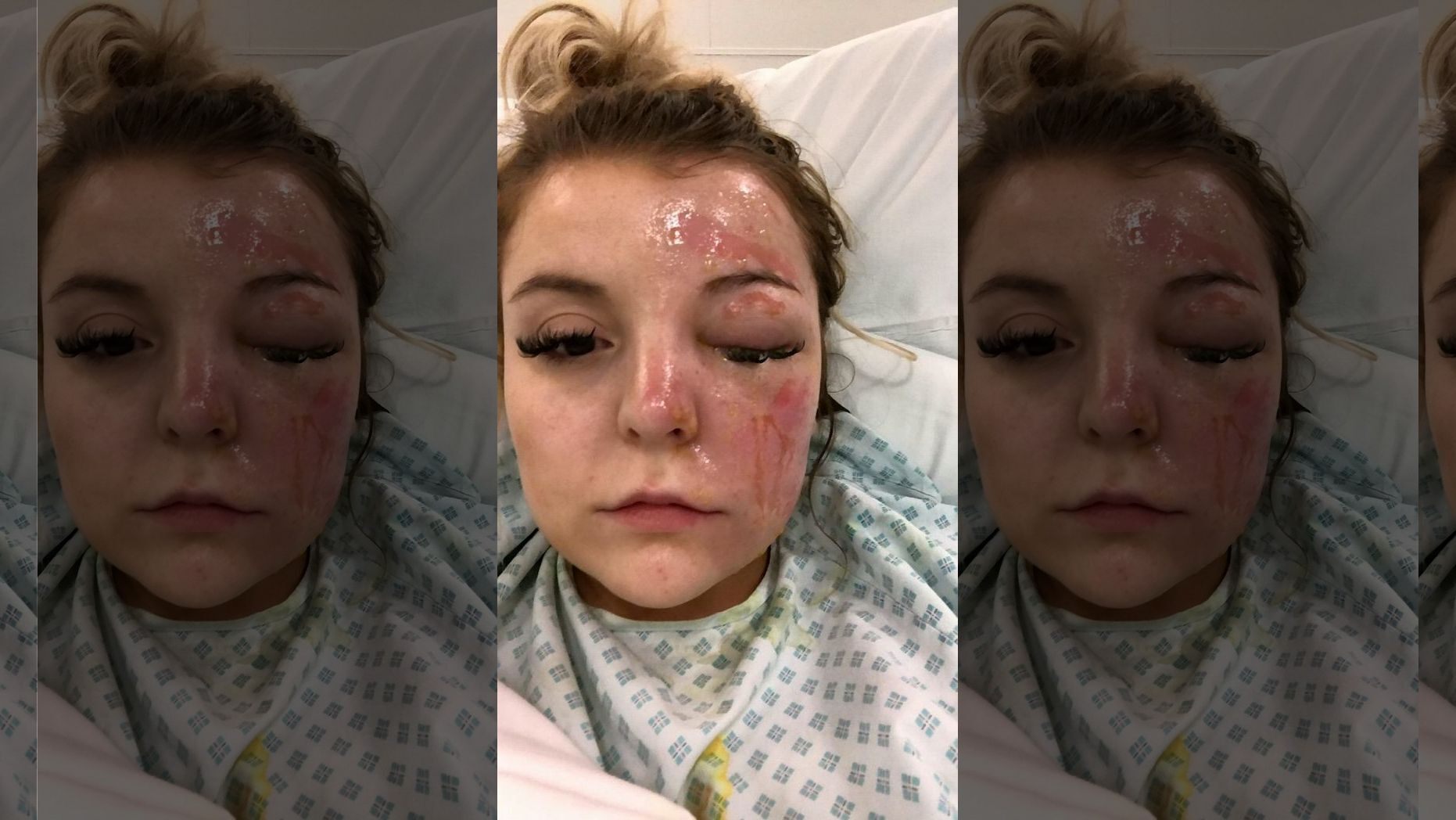 微波炉煮鸡蛋爆炸的视频,微波炉煮荷包蛋爆炸视频