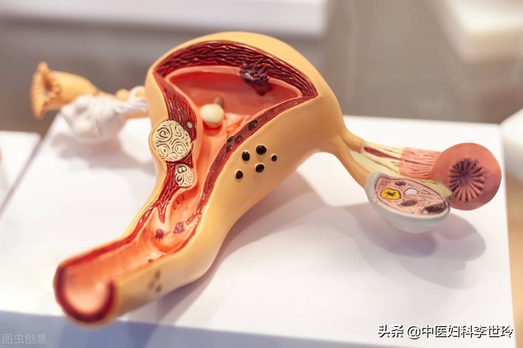 得了子宫肌瘤就不能生健康的宝宝?中药调理给宝宝一个健康的房间