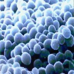 酵素排毒科普,吃减肥酵素真的能减肥吗