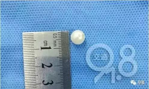 宝宝穿开裆裤的好处和坏处,冬天宝宝穿开裆裤坏处