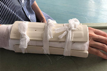 严重创伤骨折现场急救的重要性,儿童骨折如何进行现场处理