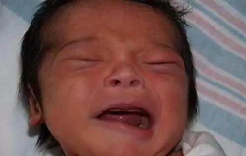 孩子突然口眼歪斜能治好吗,小孩子一觉醒来嘴歪了