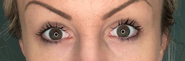 长期开车眼睛疲劳有什么好办法,长期开车有助于恢复视力