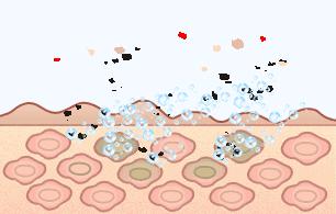 孩子长痘痘用什么中药好,小孩长痘了该怎么祛痘呢