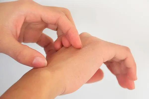 阿莫西林并非万能消炎药!不了解禁忌就乱用,容易伤身体