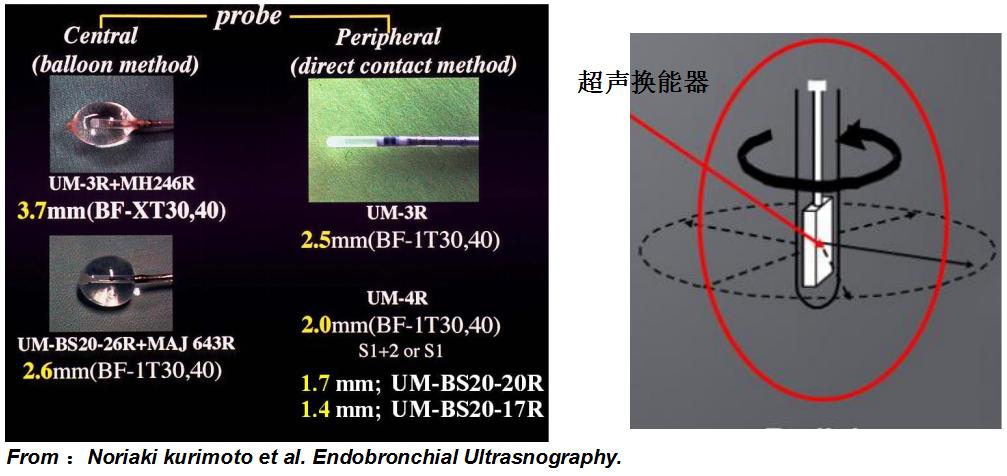 支气管镜高频电刀治疗中央型肺癌,支气管镜在早期肺癌诊断的意义