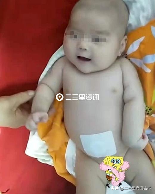 婴儿出生时臂丛神经被医生拉断,婴儿出生时手臂被医生拉断了