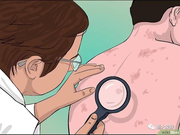 人老了身上为什么会长疮,人老了长疣什么原因