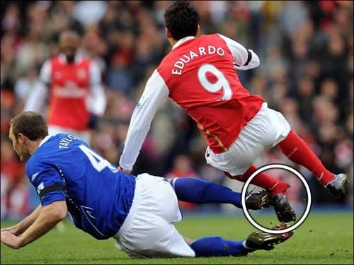 拉姆塞断脚视频,拉姆塞断脚