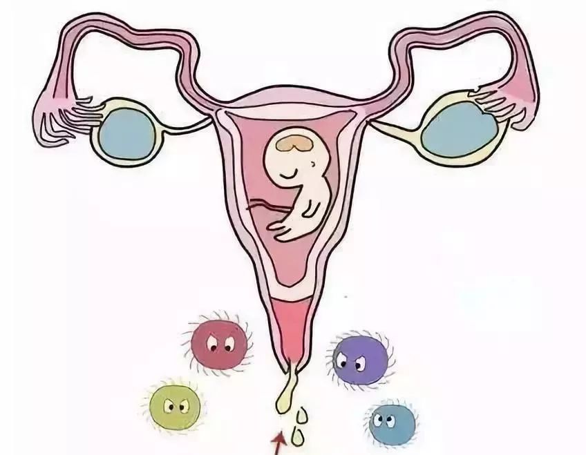 妊娠合并细菌性阴道炎用什么药,妊娠性阴道炎