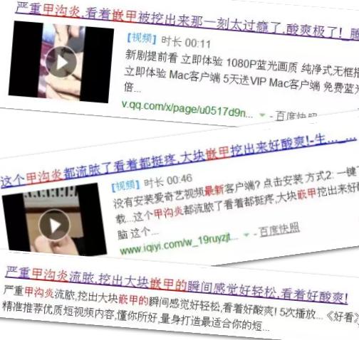 指甲长肉里导致脚发炎,指甲长到肉里甲沟炎