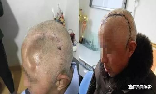 劳荣枝是怎样被警方抓到的,劳荣枝被捕采访被曝