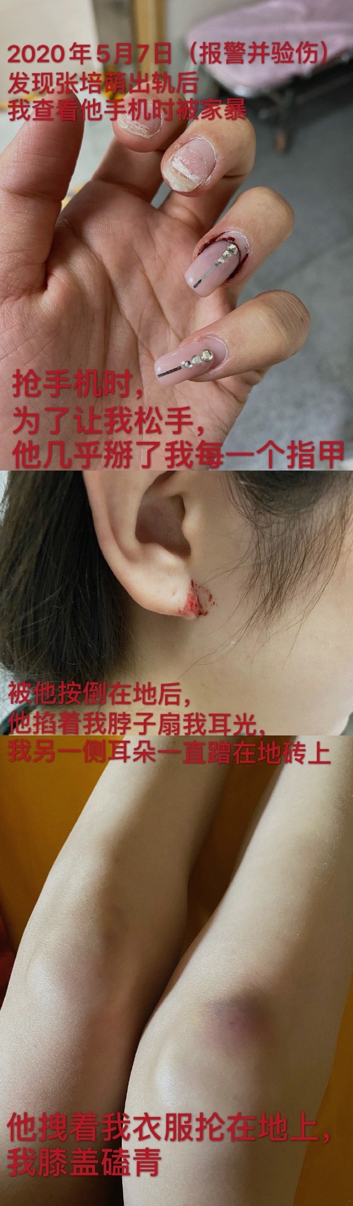 张培萌被控诉家暴,张培萌妻子回应家暴