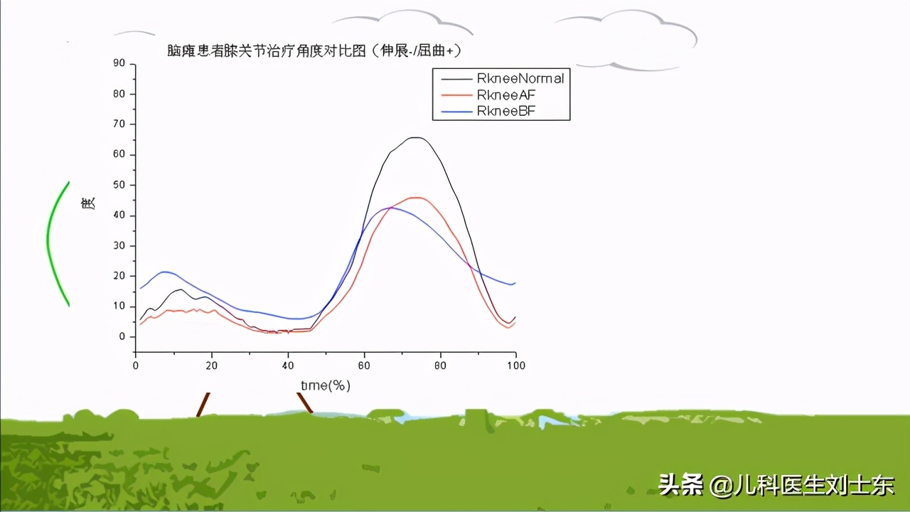 肉毒素治疗脑瘫患儿成功案例,肉毒素治疗脑瘫肌肉痉挛的效果