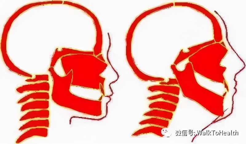 别让口呼吸毁掉你的颜值,脸毁了怎么补救