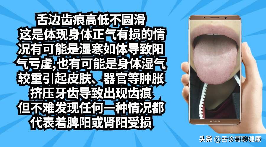 舌诊哥聊血瘀,抖音舌诊哥的感悟