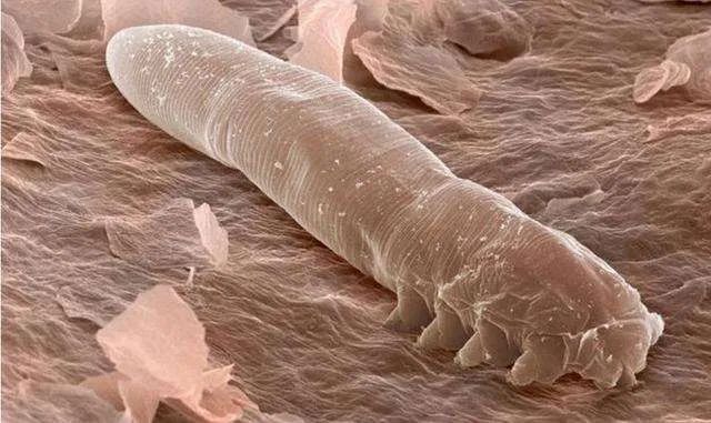 春天驱虫的生活小妙招,驱虫春季宠物