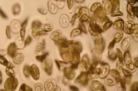 水产镜检虫图片,水产养殖常见虫类图