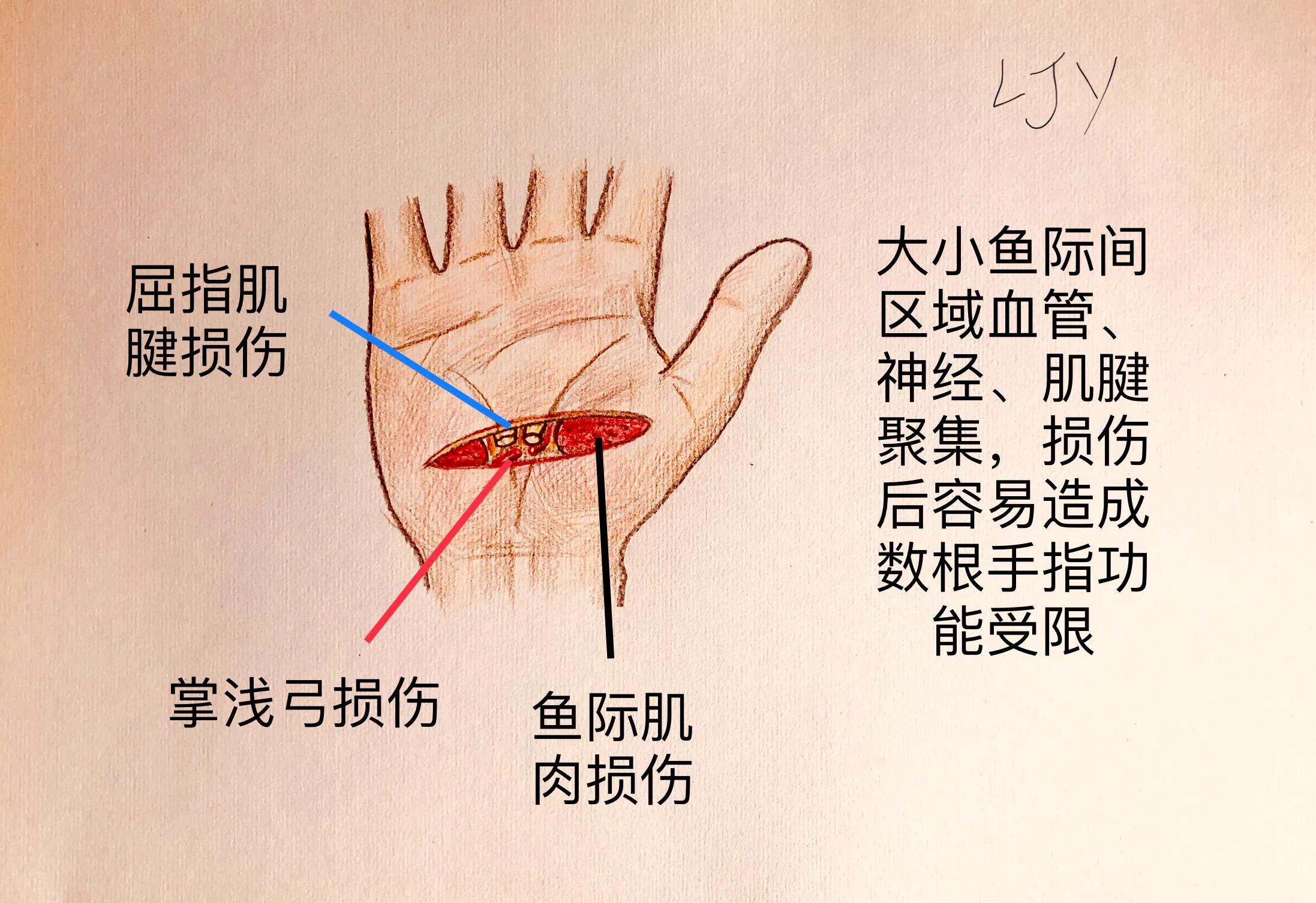 手被割伤如何处理,手被割伤了较深要如何处理