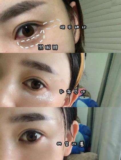 屈臣氏有没有好用的眼霜,屈臣氏好用的眼霜前十大