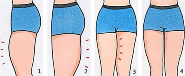 大腿松松垮垮的肉容易减吗,大腿松垮垮