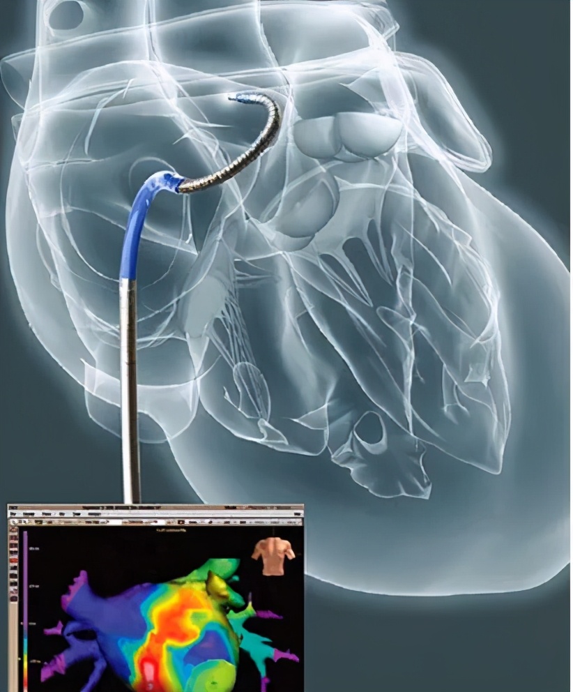 居家期间如何做好房颤疾病的自查,房颤的症状和平时保养