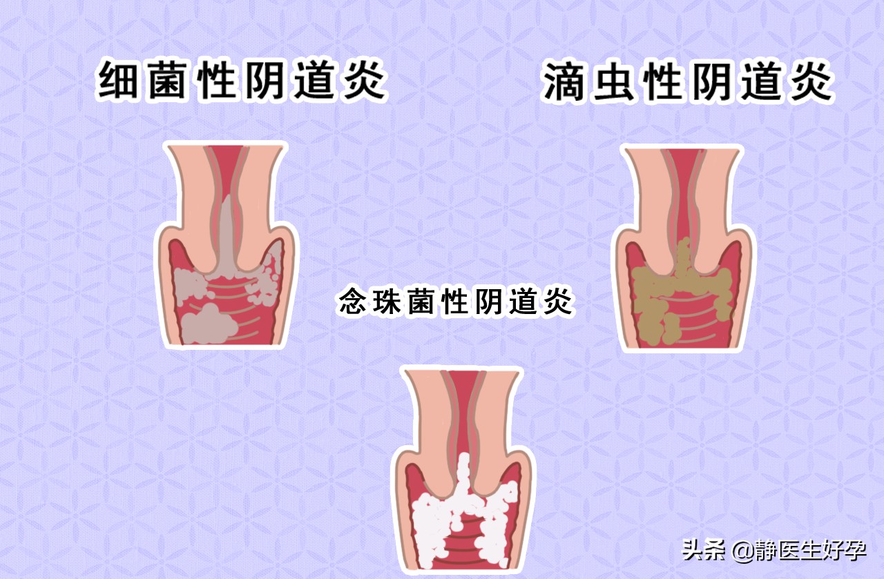 广东静医生备孕靠谱吗,静医生备孕是真的还是假的