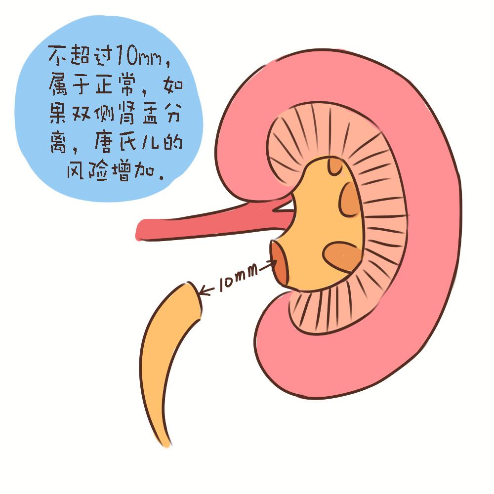 胎儿四维看哪几个指标,孕期做四维宝宝能看清楚吗