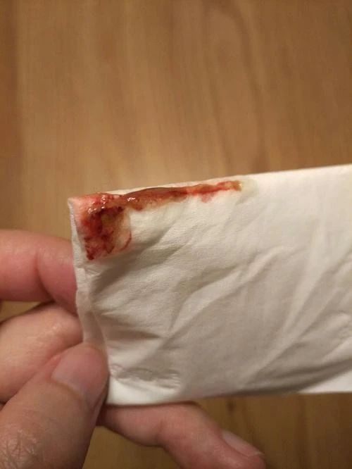 猫崽软便带血怎么办,成年猫咪便便有血什么原因