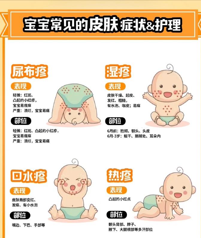 幼儿急疹出疹后怎么缓解瘙痒,幼儿急疹刚出疹后怎么护理